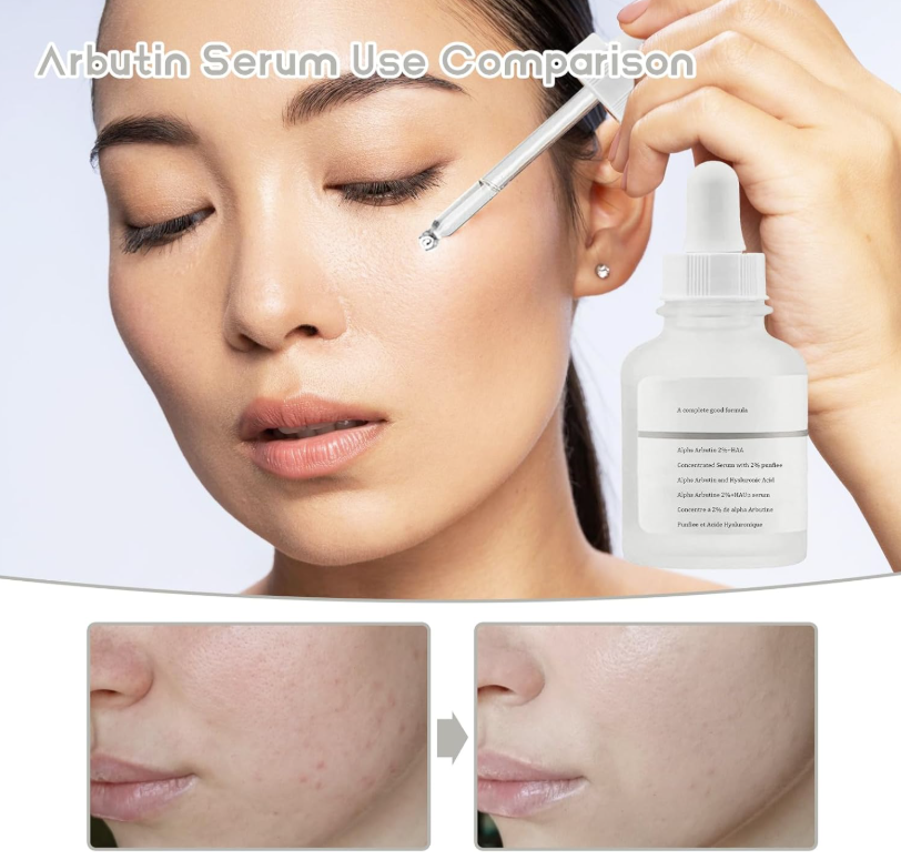 Beauty Of Joseon Glow Deep Serum Rice + Alpha Arbutin 30ml